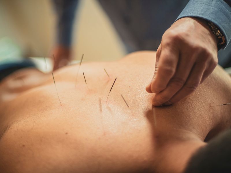 Intramuscular Stimulation In South Granville Bc