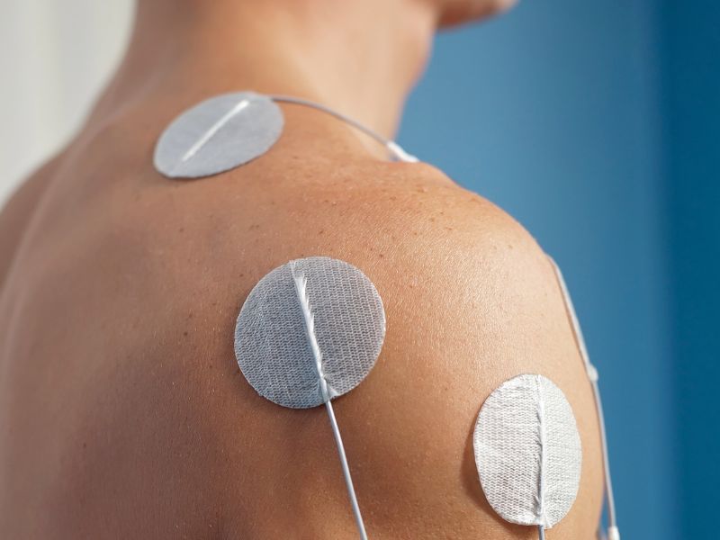 What Is The Average Cost Of Intramuscular Stimulation In Vancouver Bc